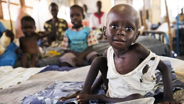 الأمم المتحدة: ثلث سكان جنوب السودان يحتاجون لمساعدات غذائية